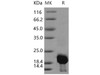 Human Calmodulin 2/CALM2 Recombinant Protein (His Tag) (RPES5102)