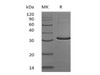 Human SCGN/Secretagogin Recombinant Protein (RPES5113)