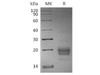 Human TIGIT Recombinant Protein (RPES5114)