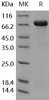 Human DC-SIGN/CD209 Recombinant Protein (Fc Tag) (RPES5123)