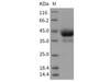 Rat ALK4/ACVR1B Recombinant Protein (Fc Tag) (Active) (RPES5128)