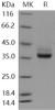 Human CSAGE/CSAG1 Recombinant Protein (Fc Tag) (RPES5136)