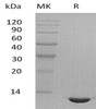 Mouse CCL24/Eotaxin-2 Recombinant Protein (RPES5148)