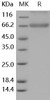 Human Decorin/DCN Recombinant Protein (RPES5162)