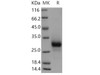 Human TNFRSF19/TROY Recombinant Protein (RPES5174)