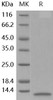 Human IL-8/CXCL8 Recombinant Protein (RPES5193)
