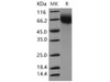 Mouse CD6/TP120 Recombinant Protein (RPES5199)