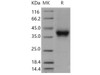 Mouse CD32/FCGR2B Recombinant Protein (RPES5200)