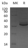 Human GPD1/GDP-C Recombinant Protein (RPES5203)