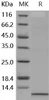 Human IL-8/CXCL8 Recombinant Protein (RPES5214)