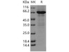 Human CCNE1/Cyclin-E1 Recombinant Protein (His & GST Tag) (Active) (RPES5238)