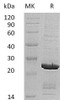 Human SOD2/Mn-SOD Recombinant Protein (RPES5248)