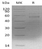 Mouse F10 Recombinant Protein (RPES5250)