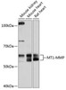 Cell Biology Antibodies 16 Anti-MT1-MMP Antibody CAB0067
