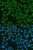 Cell Biology Antibodies 16 Anti-LRRK2 Antibody CAB0859