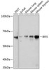 Immunology Antibodies 3 Anti-IRF5 Antibody CAB11106