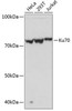 Epigenetics and Nuclear Signaling Antibodies 5 Anti-Ku70 Antibody CAB11223