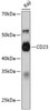 Cell Biology Antibodies 16 Anti-CD23 Antibody CAB11436