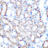 KO Validated Antibodies 1 Anti-CD168KO Validated Antibody CAB11666
