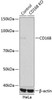 KO Validated Antibodies 1 Anti-CD168KO Validated Antibody CAB11666