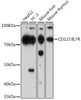 Cell Biology Antibodies 16 Anti-CD127/IL-7R Antibody CAB11678
