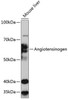 Cell Biology Antibodies 16 Anti-Angiotensinogen Antibody CAB11689