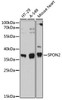 Cell Biology Antibodies 16 Anti-SPON2 Antibody CAB12077