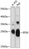 Cell Biology Antibodies 14 Anti-IFI30 Antibody CAB12995