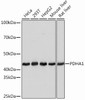 Metabolism Antibodies 3 Anti-PDHA1 Antibody CAB13687