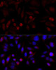 KO Validated Antibodies 1 Anti-KMT2A AntibodyKO Validated CAB1435