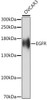 Immunology Antibodies 3 Anti-EGFR Antibody CAB16840