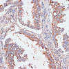 Cell Biology Antibodies 14 Anti-GAB1 Antibody CAB16856