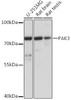 Cell Biology Antibodies 14 Anti-PAK3 Antibody CAB16942