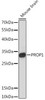 Cell Biology Antibodies 14 Anti-PROP1 Antibody CAB16963