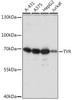 Metabolism Antibodies 3 Anti-TYR Antibody CAB16993