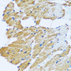 Signal Transduction Antibodies 3 Anti-ARHGEF5 Antibody CAB17014