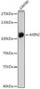 Metabolism Antibodies 3 Anti-AXIN2 Antibody CAB17022