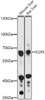 Western blot analysis of extracts of various cell lines, using CLPX antibody at 1:1000 dilution. Secondary antibody: HRP Goat Anti-Rabbit IgG (H+L) at 1:10000 dilution. Lysates/proteins: 25ug per lane. Blocking buffer: 3% nonfat dry milk in TBST. Detection: ECL Basic Kit. Exposure time: 10s.
