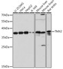 Cell Biology Antibodies 13 Anti-TMX2 Antibody CAB17148