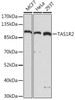 Cell Biology Antibodies 13 Anti-TAS1R2 Antibody CAB17218