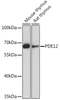 Cell Biology Antibodies 13 Anti-PDE12 Antibody CAB17270