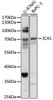 Cell Biology Antibodies 13 Anti-ICA1 Antibody CAB17500