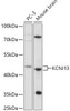 Cell Biology Antibodies 13 Anti-KCNJ13 Antibody CAB17504