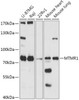 Cell Biology Antibodies 13 Anti-MTMR1 Antibody CAB17575