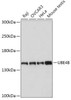 Cell Biology Antibodies 13 Anti-UBE4B Antibody CAB17609