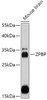 Cell Biology Antibodies 13 Anti-ZPBP Antibody CAB17625
