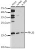 Cell Biology Antibodies 13 Anti-RPL35 Antibody CAB17632