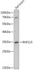 Cell Biology Antibodies 13 Anti-RNF115 Antibody CAB17687