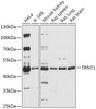 Cell Biology Antibodies 13 Anti-TRNT1 Antibody CAB17699