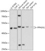 Cell Biology Antibodies 13 Anti-PPHLN1 Antibody CAB17706